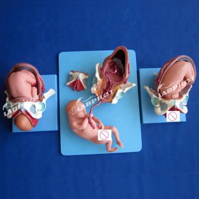 China Medical Anatomical Demonstration Model Childbirth Pelvis and Full-term Fetus Model for sale