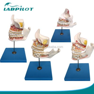 Cina Funzione Dimostrare denti molari inferiori Strutture anatomiche dettagliate per la ricerca dentale in vendita