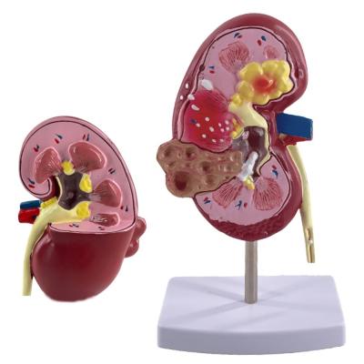 China PVC Pathological Kidney Model for Medical Schools and Urology Hospitals Demonstration for sale