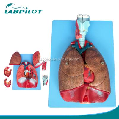 China 3D-Modell des menschlichen Atmungssystems, Larynx, Trachea, Herz und Lunge für medizinische Ausbildung zu verkaufen