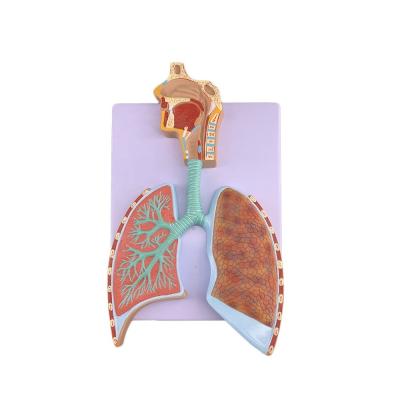 China Modelo avanzado de anatomía pulmonar de PVC para una demostración precisa del sistema respiratorio en venta