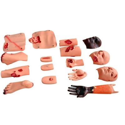 China Realistic Human Simulation for Nursing Training Burn Wound Fracture and Amputation Care for sale