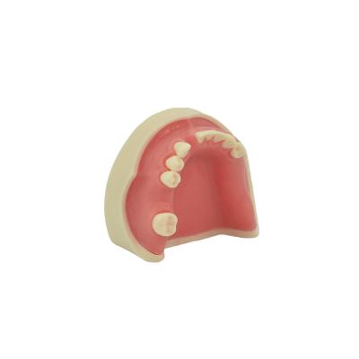 China Medical School High Quality Real Maxillary Sinus Implant Practice Model for sale