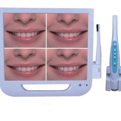 China High Quality 17 Inch WIFI Dental Oral Camera Metal Intra/Dental Endoscope System With 1 Year Warranty for sale