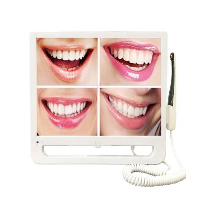 China Dental Intraoral High Definition 12 Mega Pixels Metal Intra Oral Camera With 17 Inch LED Monitor for sale