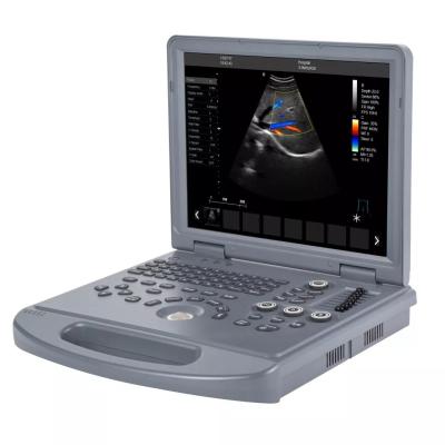 China Verbesserter Laptop-Farb-Doppler-Ultraschall-Scanner zu verkaufen