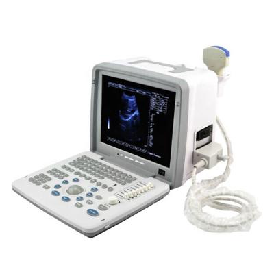 China 12 Inch Metal Portable Medical Black And White Ultrasound Scanner Ultrasound Machine for sale