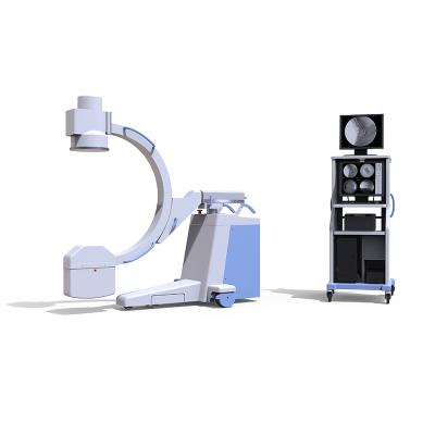 China Portable Medical Mobile Metal Hospital Digital C-arm X-ray Examination Machine for sale