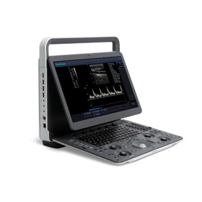 China E1 Hospital Used Sonoscape Ultrasound Medical Equipment Full Mode Digital Ultrasound Machine for sale