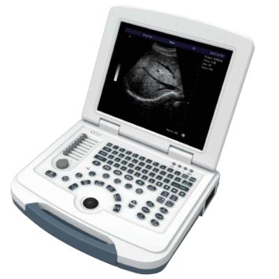 Cina Full Digital Wireless Ultrasound Machine Operating Room Supplies For Human in vendita