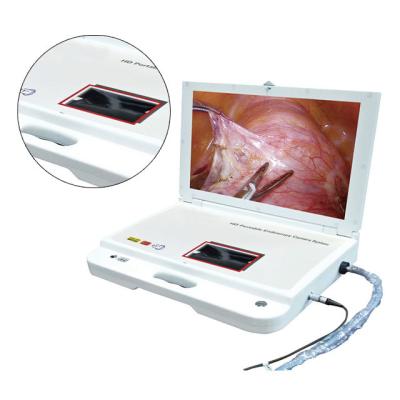 중국 Hospital ENT Medical Equipment Digital Portable Endoscope System 판매용