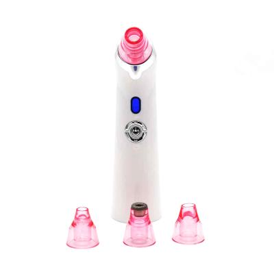 China Low Noise Remover Face Acne Treatment Blackhead Vacuum Suction Beauty Device Vacuum Blackhead Remover Vacuum Blackhead Remover for sale