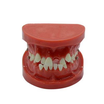 China School and hospital factory direct sale study human anatomical orthodontic teeth model for sale