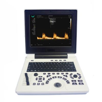 China China Top Metal Ultrasound Machine Ultrasound Scanner Medical Ultrasound Instruments for sale