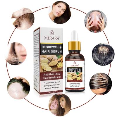 China Wholesale Hair Loss Treatment Color-protecting Anti Repairing Ginger Essential Oil Women Biotin Hair Growth Oil Hair Regrowth Serum Oil For Men for sale