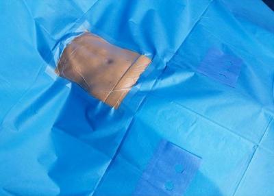 China Hospital Sterile Surgical Abdominal Drape Sheet Disposable OEM Service for sale