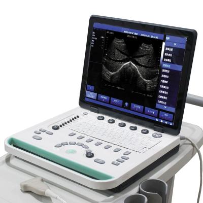 China PRUS-S8000 15inch Laptop Ultrasound Scanner Machine PRUS-S8000 for sale