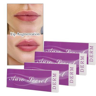 China Derm 1 ml 2 ml Filler Lippenvergrößerung Dermal Filler Injektion zu verkaufen