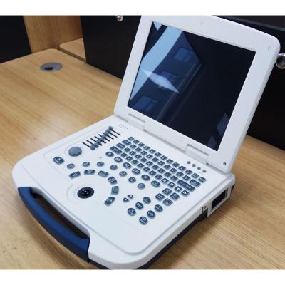 China US580 Metal Base Table Abdominal Ultrasound BW Scanner Machine Price for sale