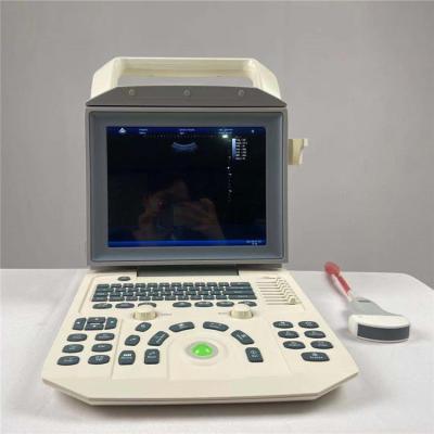 China Diagnostic B/W Ultrasound System All Digital For Obstetric And Gynecologic Hospital for sale