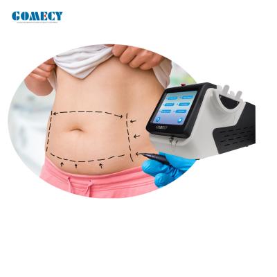 China Máquina láser de liposucción de 980nm de grado médico para la pérdida de grasa / tratamiento de la onicomicosis en venta