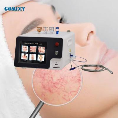 China 1470nm 980nm Diode Laser Veins Removal Machine Vascular Surgery Instruments Te koop