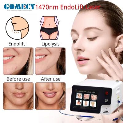 China Laser Endolift 1470nm 980nm Dubbele Golflengtes Gezichtsschoonheid Laser EVLT ENT PLDD Spataderen Verwijdering Machine Te koop