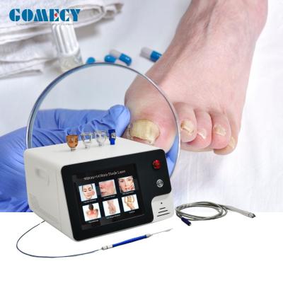 Cina 980nm Nail Fungus Removal Laser Nail Disease Therapy Non invasivo tipo trattamento laser per unghie in vendita