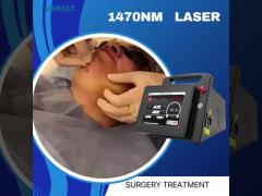 Endolaser 1470 Liftinging Facial Lipolysis Endovenous Laser Spider Vein Removal