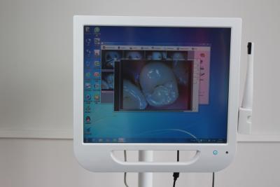 China Touch Screen 17Inch Japan LCD Monitor with Intra oral Dental Camera for sale