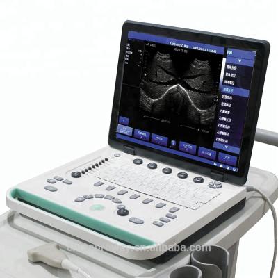 China Veterinary Equipment: PRUS-S8000V 15inch Veterinary Laptop Ultrasound Scanner Machine 15inch LCD Screen for sale