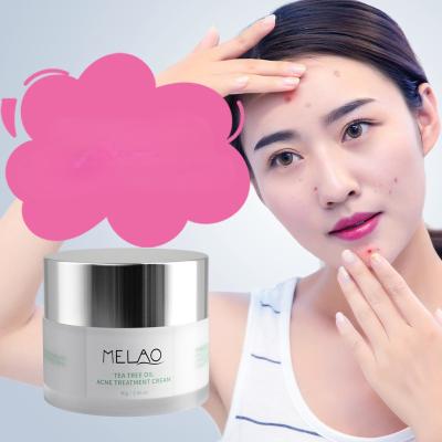 China Moisturizer Skin Care Hyaluronic Acid Moisturizing Vitamin Night Cream for sale