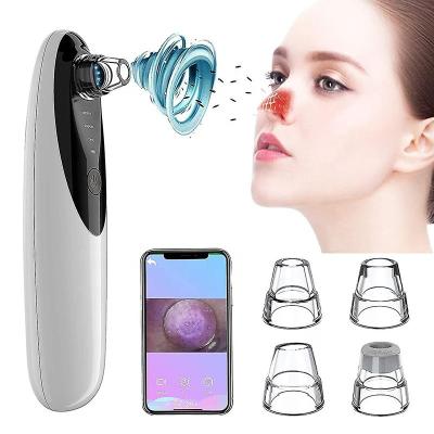 China Acne Treatment Dropshipping 1080hd Video Portable Electric Usb Rechargeable Blackhead Removal With Cameral for sale