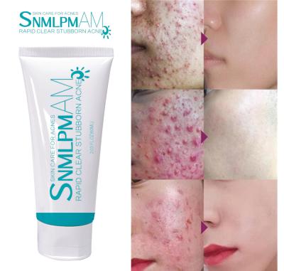 China Best Skin Revitalizer Skin Care Repair Anti Acne Scar Removal Cream Acne Epiderm Cream For Acne for sale