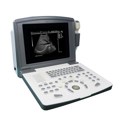 China Mianyang Metal United MDK660 Cheapest Portable Ultrasound Machine Black And White for sale