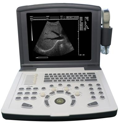 China MDK-660D Portable Metal Ultrasound Scanner Black And White Ultrasound Machine With Built-in Battery for sale