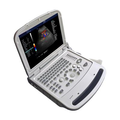 China United metal ultrasound mdk 870 portable color doppler ultrasound scanner hot product machine 2021 for sale