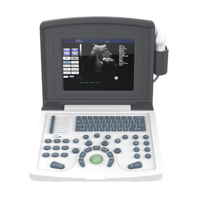 China Portable Black And White Metal United Ultrasound Ultrasound Scanner Machine In Medical for sale