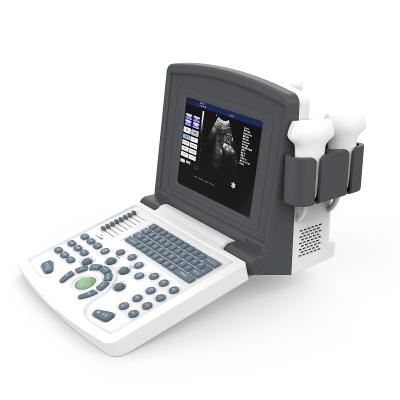 China Metal mdk 660 b portable ultrasound black white ultrasound also has color doppler type for sale