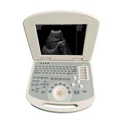 China 2021 united metal ultrasound mdk 860 hot product b/w laptop ultrasound laptop for sale