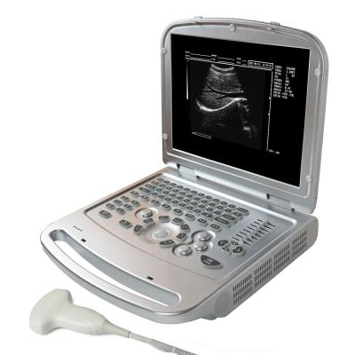 China BW laptop mdk 830 metal united ultrasound black and white ultrasound scanner portable ultrasound machine for sale