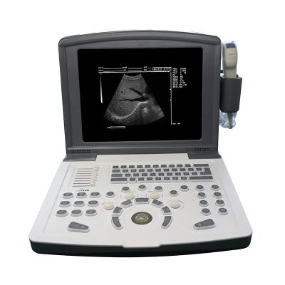 China Laptop Black and White Ultrasound Scanner MDK-660D Metal Ultrasound Medical Ultrasound Instruments for sale