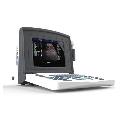 China 2021 Cheap Metal Ultrasound Price Laptop Computer Ultrasound Scanner United Color Doppler Scanner Machine for sale