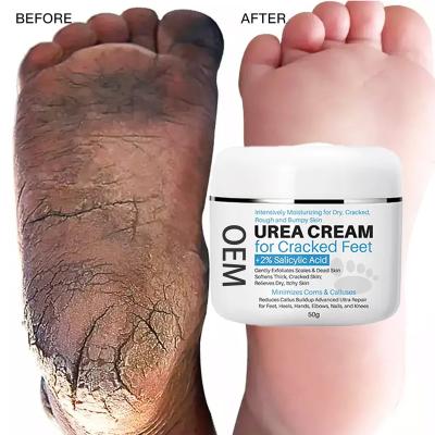 China Moisturzing OEM ODM Skin Removal Hand Foot Cream Salicylic Acid Natural Organic Urea 40% Dead Hand Foot Peeling Cream For Cracked Heels for sale