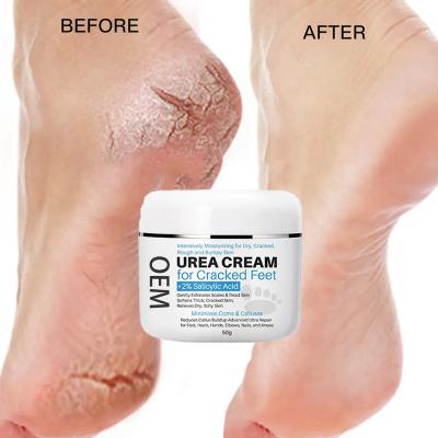 China Natural Organic Moisturzing Custom Peeling Herbal Dead Skin Removal Vitamin C Whitening Vegan Anti Crack 40% Urea Foot Cream For Cracked Heels for sale