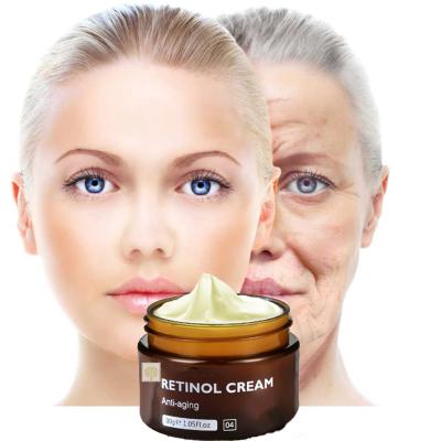 China Dark Spot Anti Aging Kojic Acid Cream Wholesale Anti Aging Face Wrinkle Beauty Removing Acne Skin Whitening Retinol Brightening Face Cream for sale