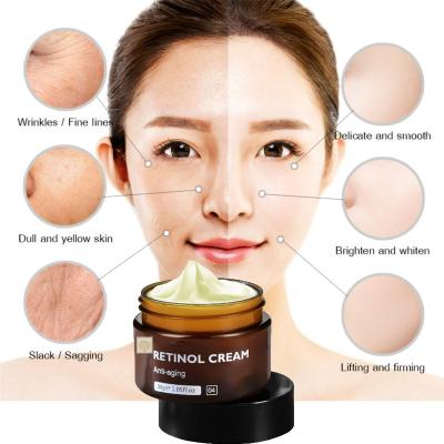 China Retinol Anti Aging Anti Aging Cream Moisturizer For Face And Neck Wrinkle Cream Retinol Complex Whitening Collagen Retinol Cream for sale