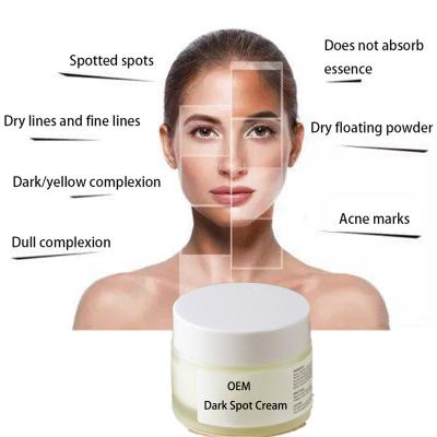 China Dark Circles Wholesale Whitening Anti Freckle Cream Improve Skin Dullness And Luster Hydrating And Rejuvenating Skin Remove Spots for sale