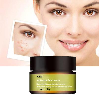 China Nourishing Result Acne Spot Remover Cream Private Label OEM Face Cream Ready To Use Whitening Cream For Skin Care for sale