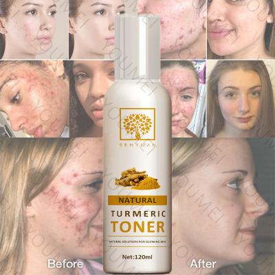 China New Arrival Green Tea Toner Turmeric Whitening Moisturizer Anti Wrinkle Face Toner , Face Skin Care Vitamin C Turmeric Toner for sale